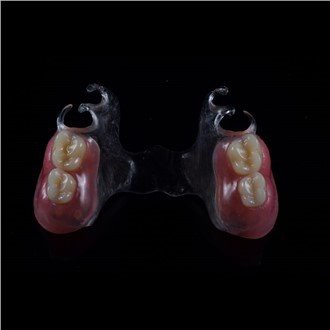 Snímatelná akrylová částečná protéza